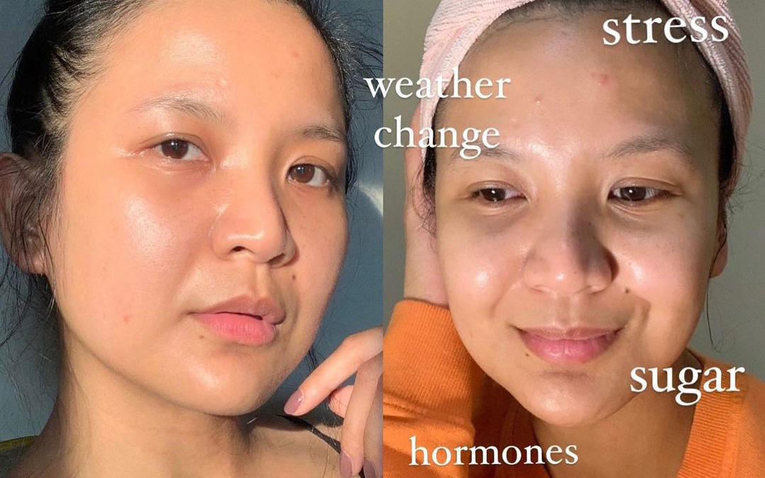 6 th&oacute;i quen khiến da bạn ng&agrave;y c&agrave;ng xuống dốc - Ảnh 1.