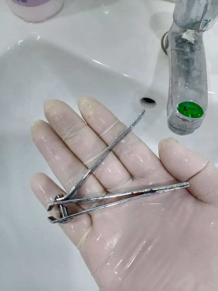 Ớn lạnh với người đàn ông ngậm chiếc bấm móng tay rồi vô tình nuốt chửng