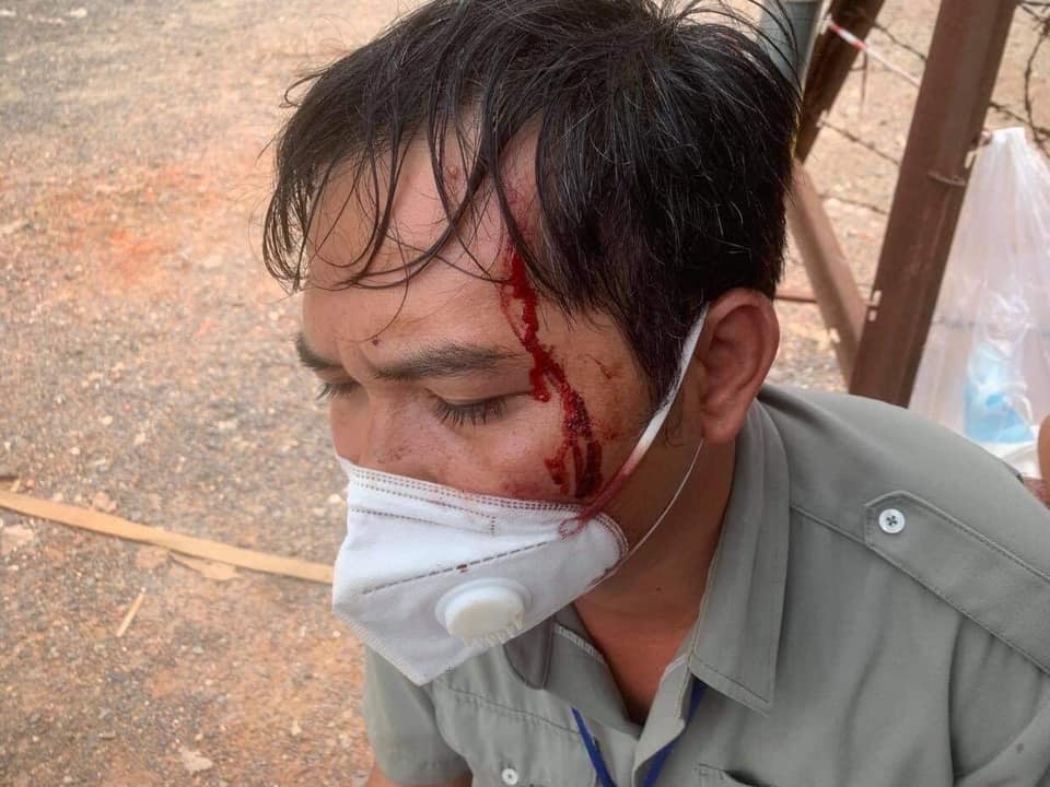 D&acirc;n qu&acirc;n, d&acirc;n ph&ograve;ng ẩu đả với 2 người d&acirc;n ở Đồng Nai: Do leo r&agrave;o qua chốt bị ph&aacute;t hiện - Ảnh 2.