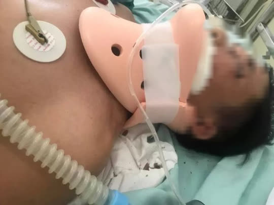 Người đàn ông bị đánh trước trụ sở viện kiểm sát đã tử vong