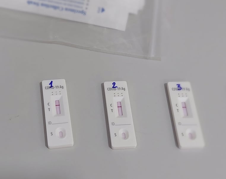 Vạch T đậm, mất khứu giác có phải lượng virus nhiều?