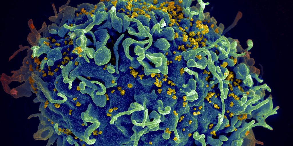 Kỳ diệu người phụ nữ tự loại bỏ HIV