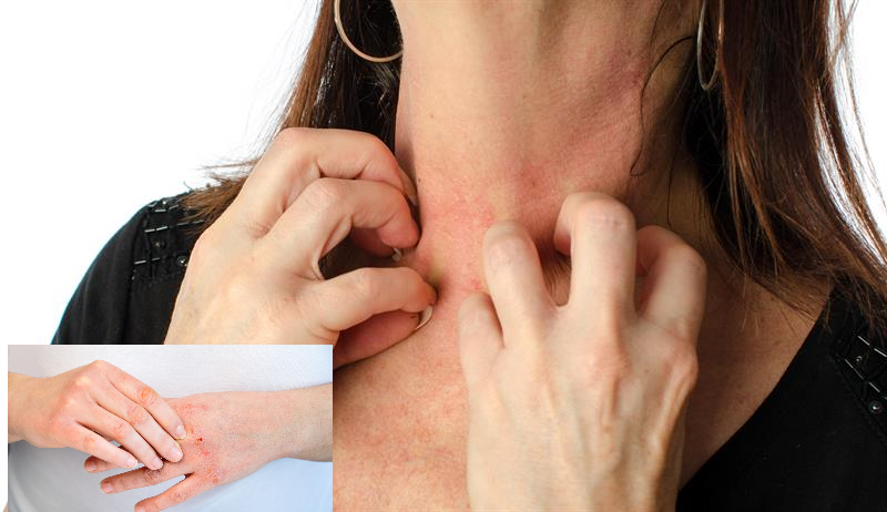 Ngứa đến phát điên, bác sĩ chỉ cách xử lý đơn giản - Ảnh 1.