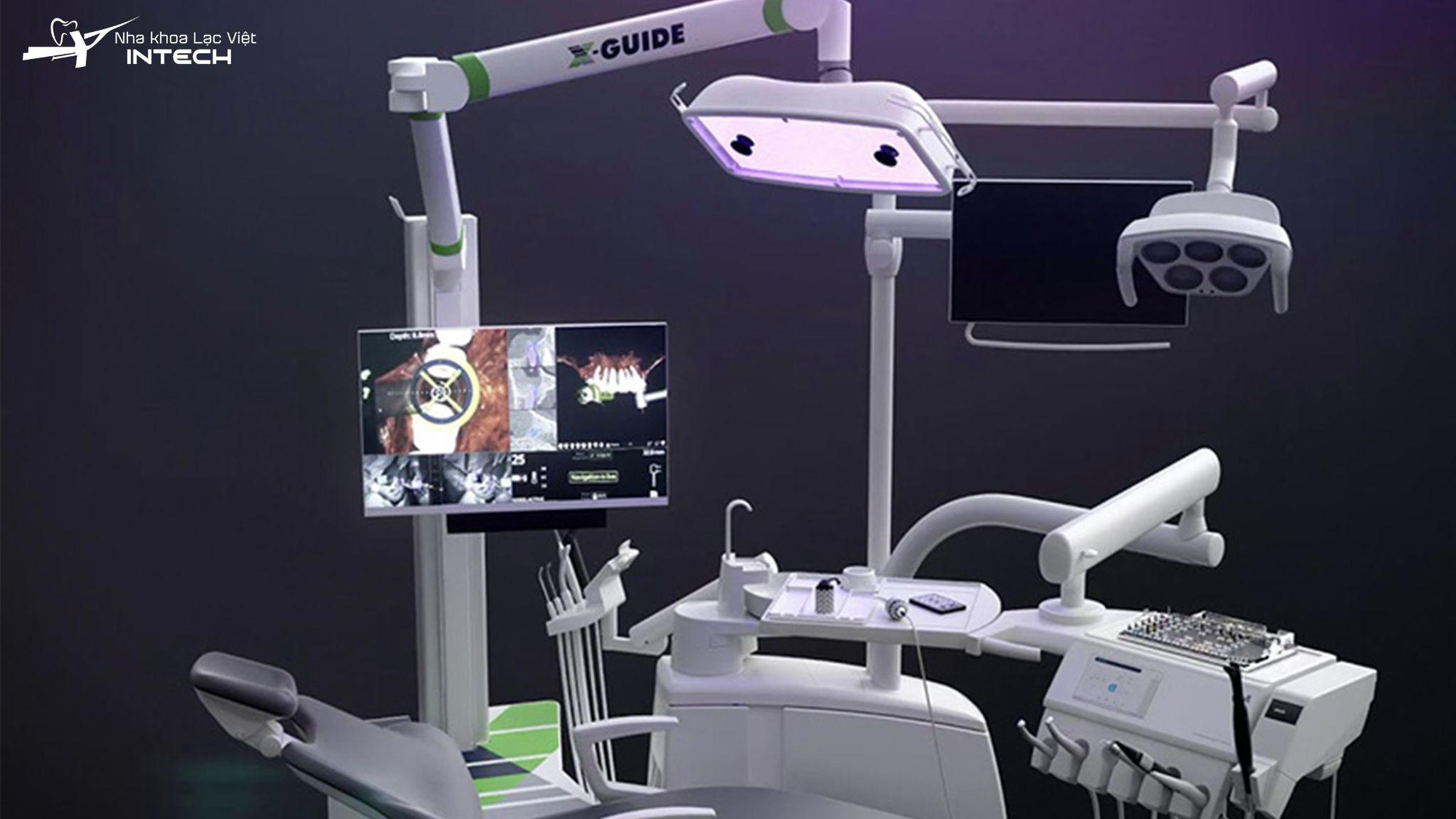 Nha khoa Lạc Việt Intech trồng răng implant bằng c&ocirc;ng nghệ Safe-Tech - Ảnh 2.