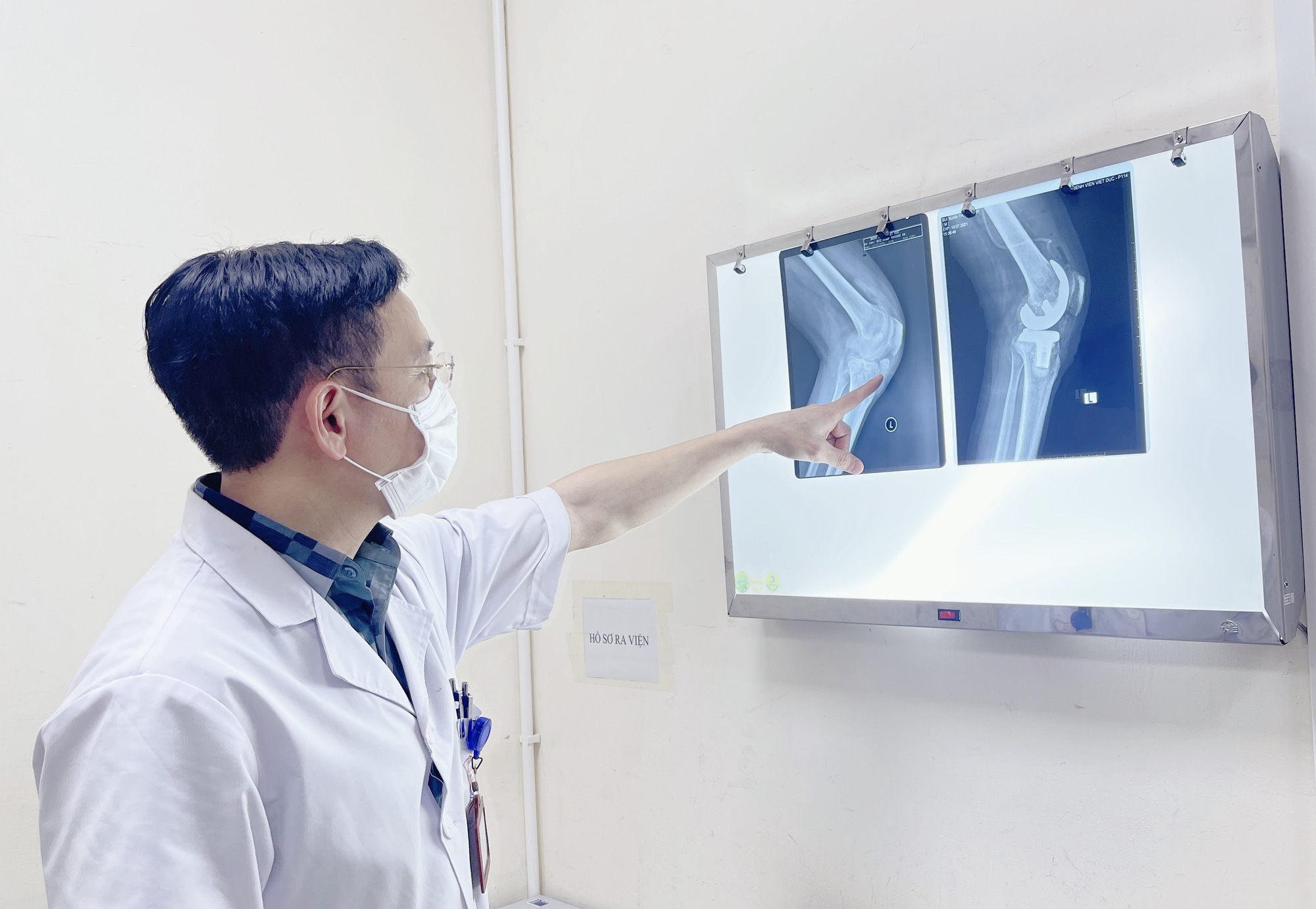 Mắc bệnh gout, nam thanh niên phải thay khớp gối 2 bên - Ảnh 1.