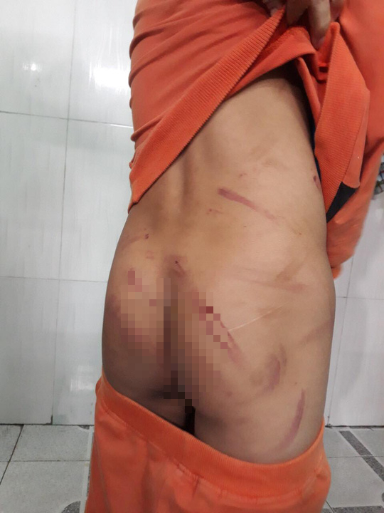 Cháu bé 7 tuổi bị cha ruột đánh bầm dập vì học chậm tiến - Ảnh 4.