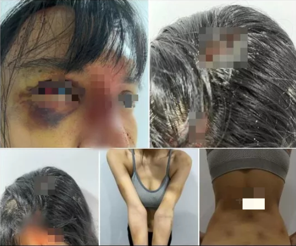 Siêu mẫu Khả Trang bị bạo hành đến "thân tàn ma dại'?