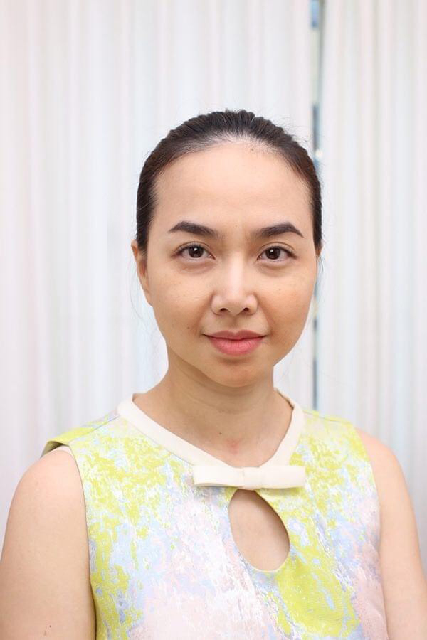 LaSol Beauty Clinic ra mắt c&ocirc;ng nghệ trẻ h&oacute;a da th&ocirc;ng minh đa tầng mới - Ảnh 3.