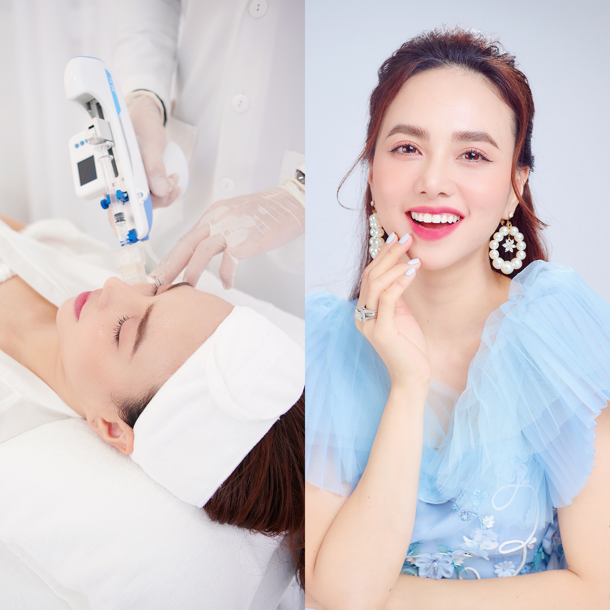 LaSol Beauty Clinic ra mắt c&ocirc;ng nghệ trẻ h&oacute;a da th&ocirc;ng minh đa tầng mới - Ảnh 4.