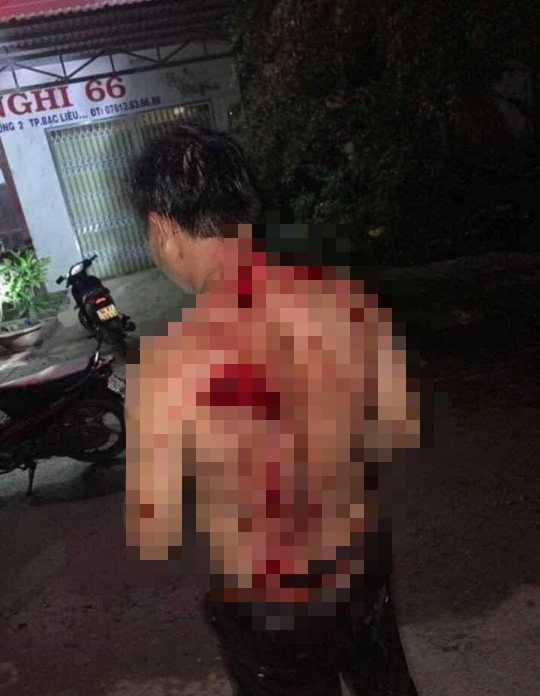 Điều tra vụ thượng &uacute;y bi&ecirc;n ph&ograve;ng ở Bạc Li&ecirc;u ch&eacute;m 2 người trọng thương - Ảnh 4.