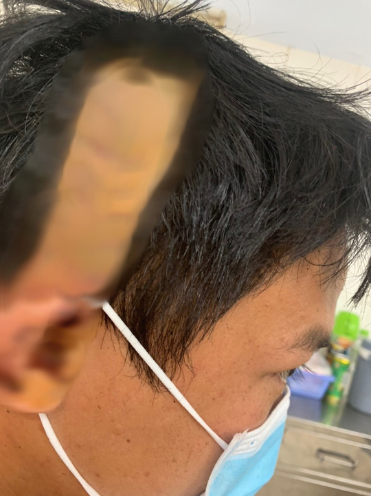Điều tra vụ thượng &uacute;y bi&ecirc;n ph&ograve;ng ở Bạc Li&ecirc;u ch&eacute;m 2 người trọng thương - Ảnh 5.