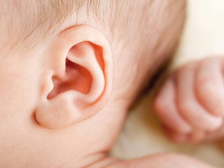 Dị dạng vành tai có phẫu thuật được không?