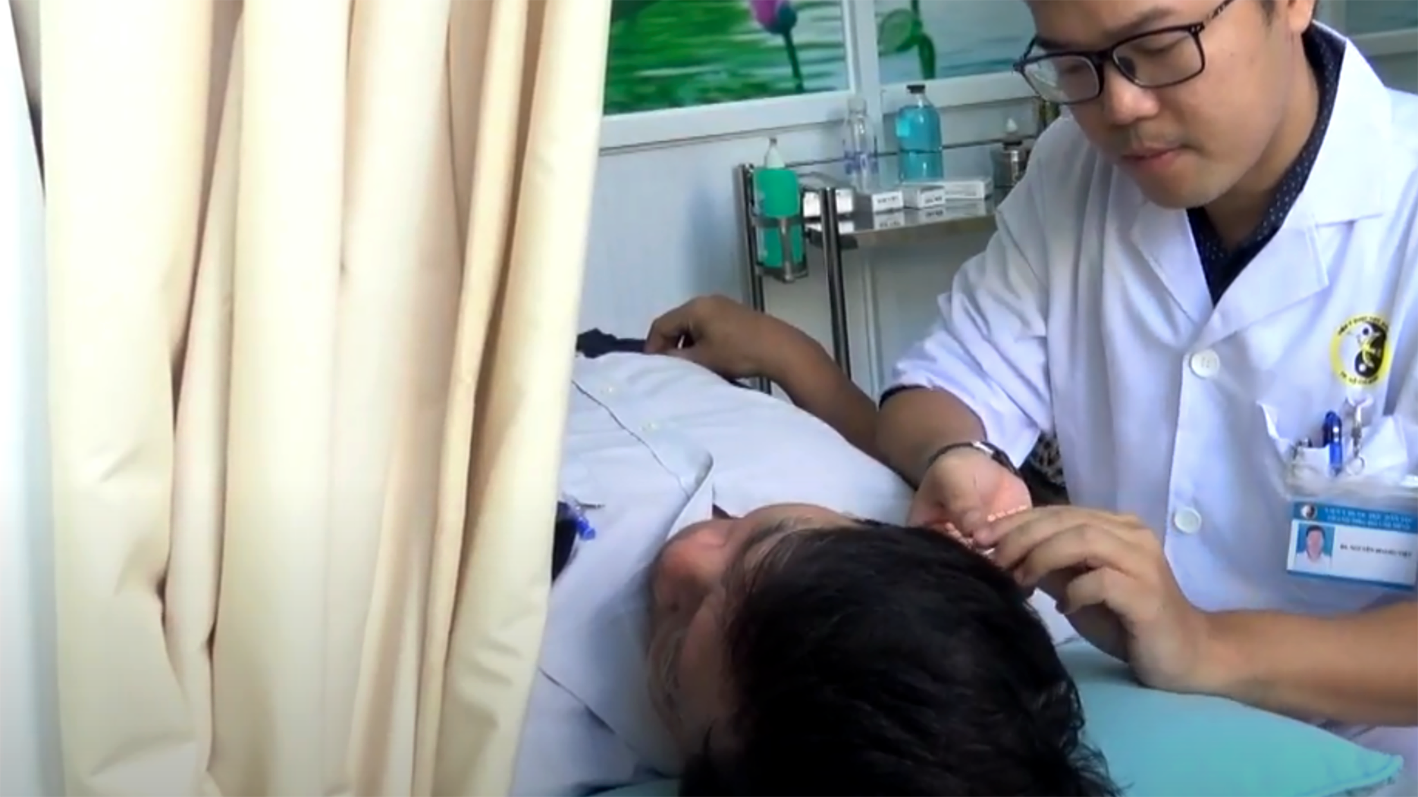 Châm cứu cai thuốc lá