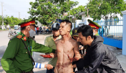 Kẻ ngáo đá ở Quảng Nam tự cắt cổ, liên tục la "giết người"