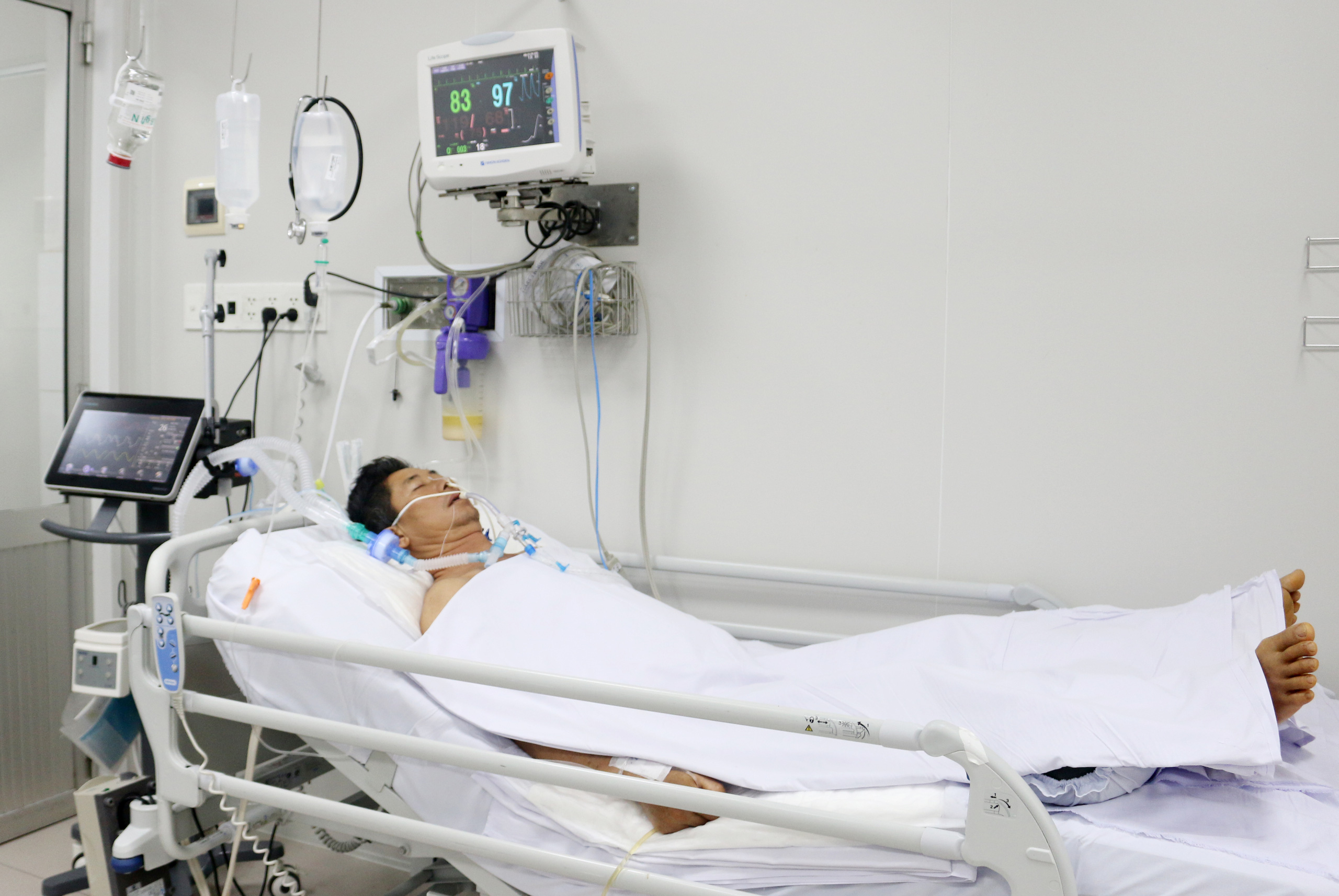 Một phụ nữ hôn mê sâu sau khi ăn bún riêu chay