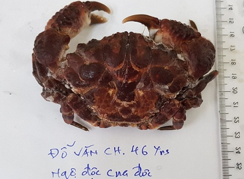 Ăn cua mặt quỷ, người đàn ông bị liệt toàn thân, ngộ độc nguy kịch