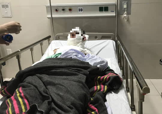 Cháy thùng xăng trên tàu cá, 3 ngư dân bị bỏng nặng nguy kịch