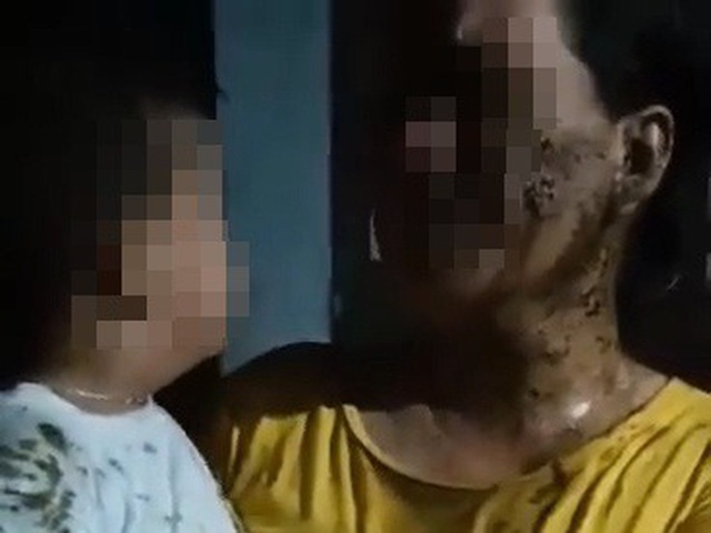 ĐBQH Phạm Thị Minh Hiền: Đổ chất bẩn lên trẻ 2 tuổi là xâm hại trẻ em nghiêm trọng