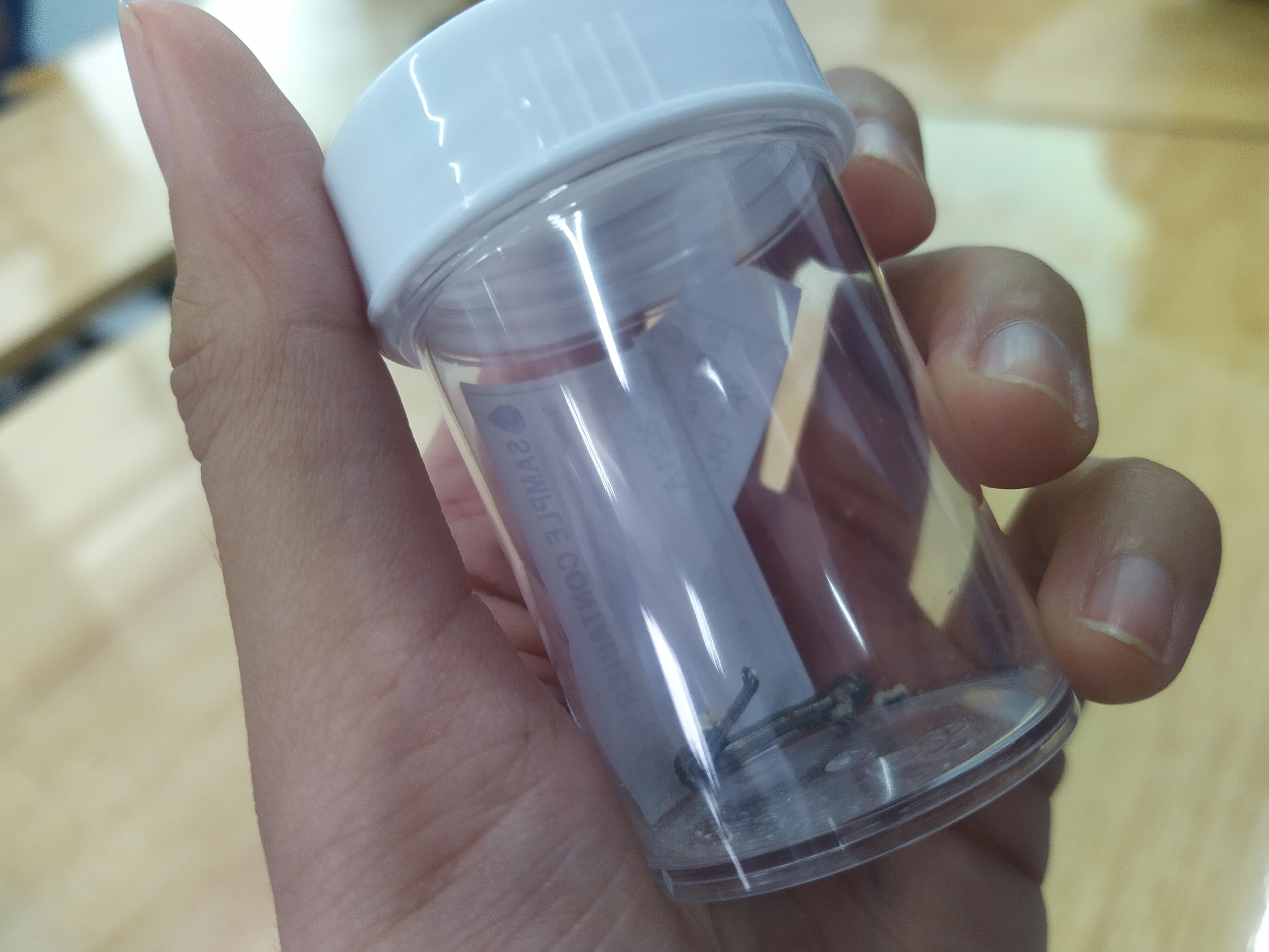 Mở lồng ngực cứu b&eacute; trai bị m&oacute;c d&acirc;y k&eacute;o lọt v&agrave;o vị tr&iacute; nhạy cảm - Ảnh 2.
