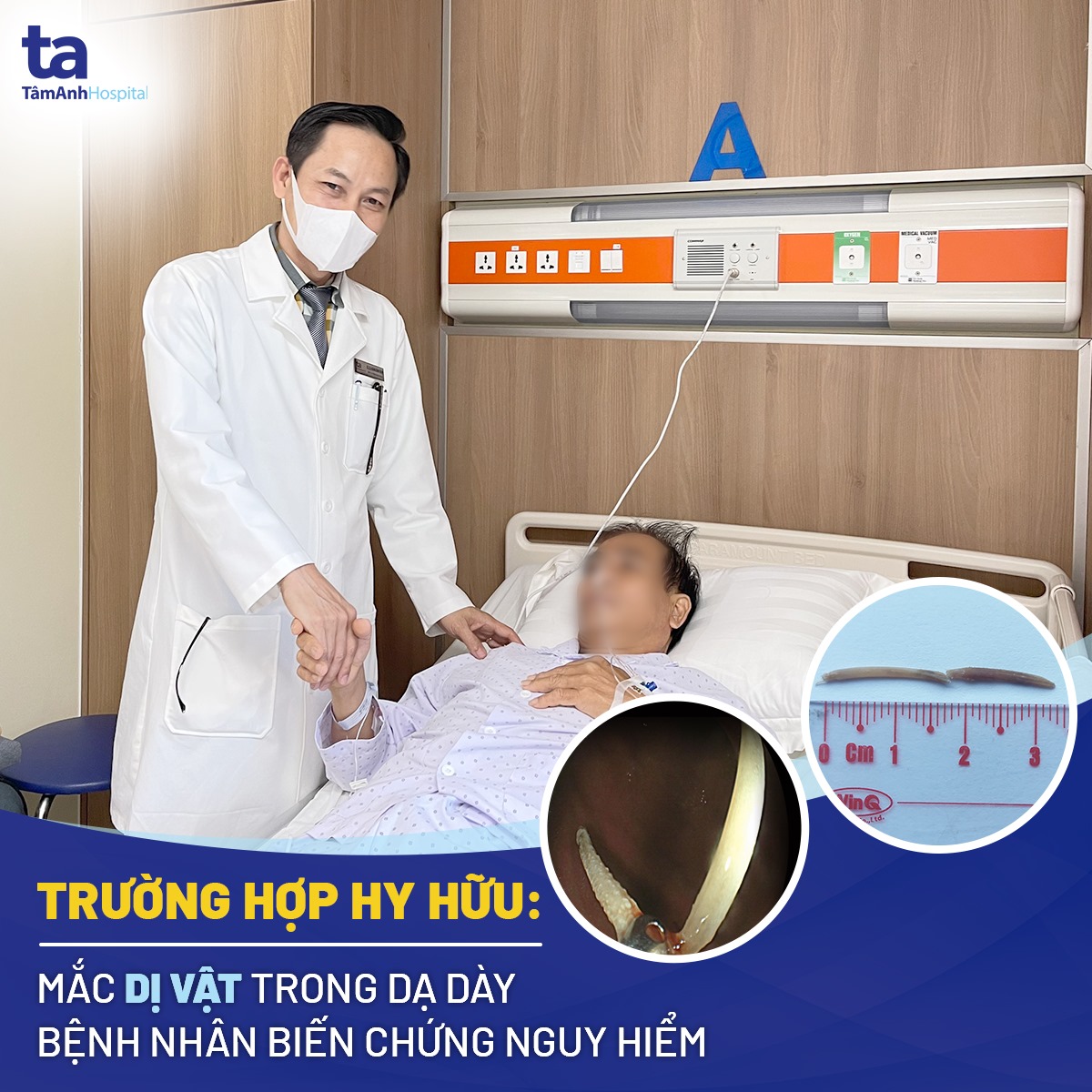 Một người đàn ông Bến Tre bị "ngà voi" xuyên thủng gan