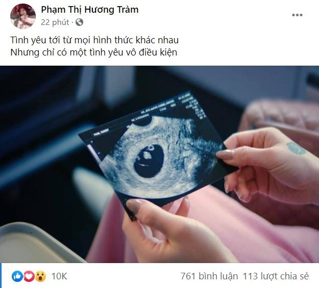Hương Tràm với bức ảnh gây chú ý