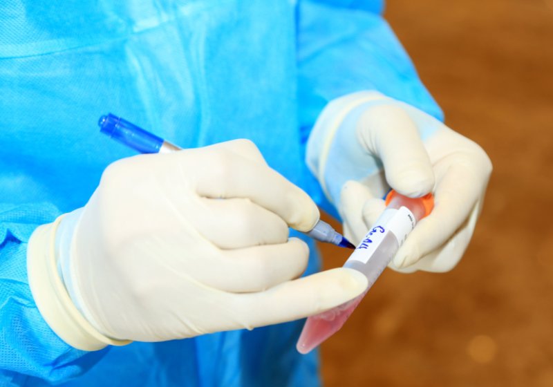 Nam thanh niên dương tính SARS-CoV-2 sau khi từ Bắc Giang về quê Thanh Hóa - Ảnh 1.