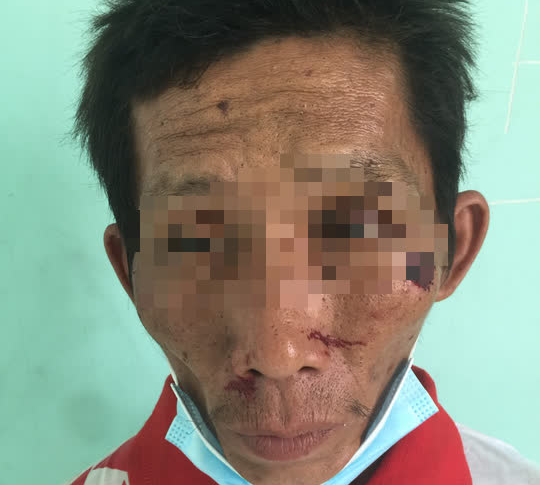 Bắt giữ nghi phạm gây cháy chi nhánh ngân hàng ở Kiên Giang