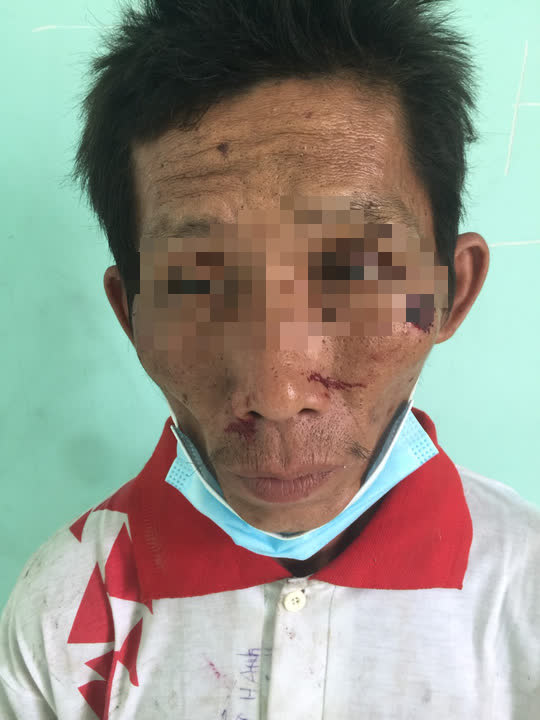 Bắt giữ nghi phạm g&acirc;y ch&aacute;y chi nh&aacute;nh ng&acirc;n h&agrave;ng ở Ki&ecirc;n Giang - Ảnh 1.