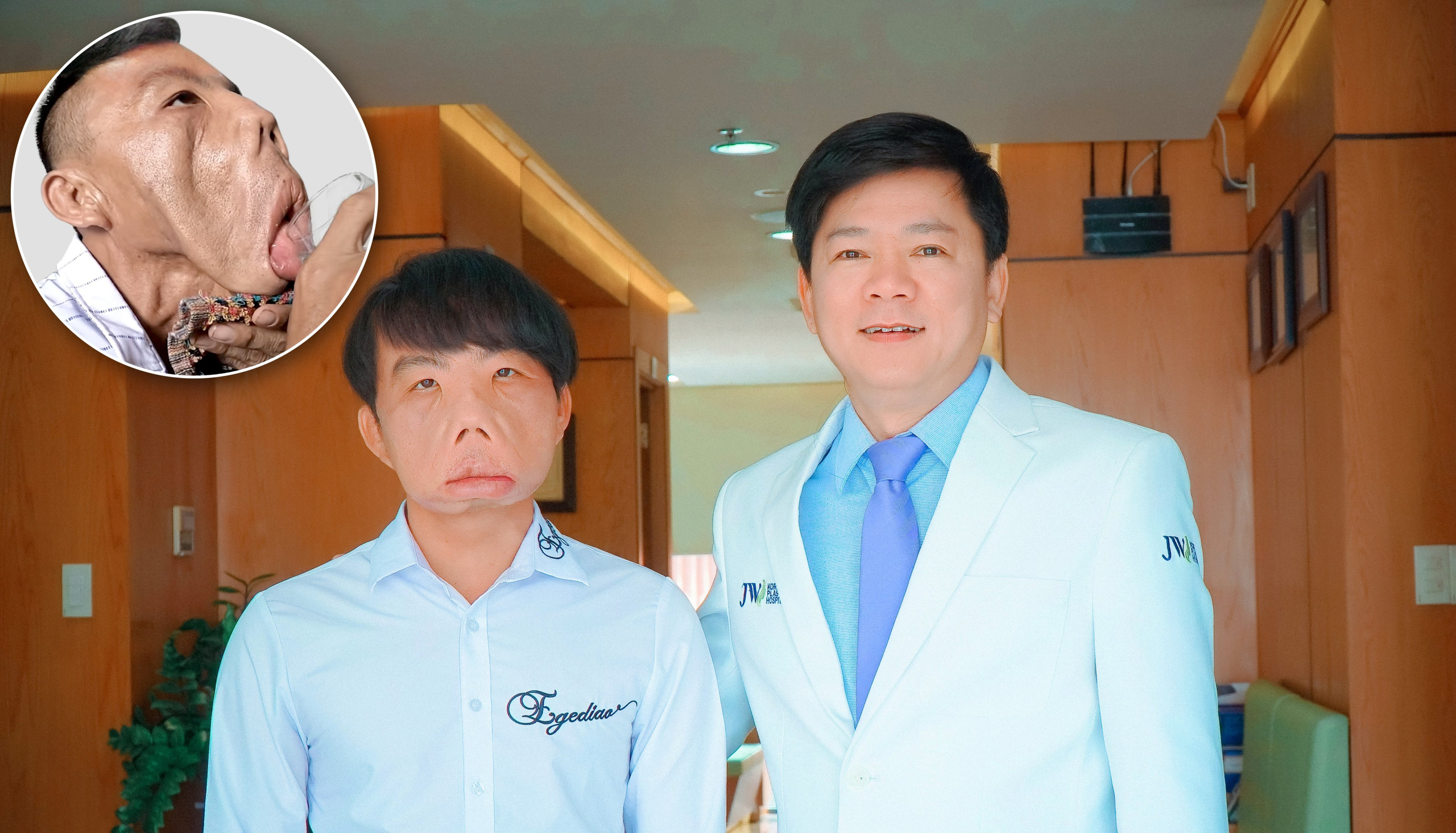 Chàng trai “mặt quỷ” bây giờ ra sao?