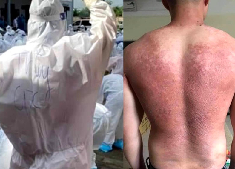 Mồ hôi ròng ròng, bỏng rát trong bộ đồ bảo hộ dưới nắng nóng gần 40 độ C ở tâm dịch