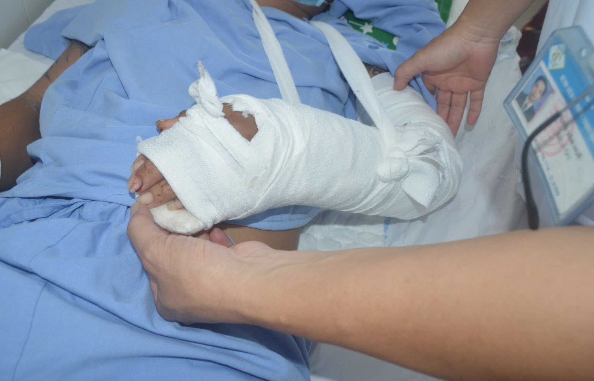 Nhờ kịp thời cho v&agrave;o chậu nước đ&aacute;, b&agrave;n tay đứt l&igrave;a được nối th&agrave;nh c&ocirc;ng - Ảnh 2.