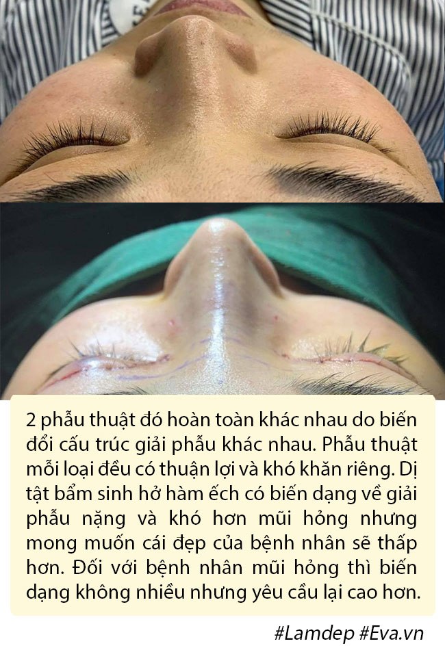 Dao k&eacute;o hỏng: Nỗi khổ của bệnh nh&acirc;n v&agrave; c&aacute;i kh&oacute; của b&aacute;c sĩ - Ảnh 11.