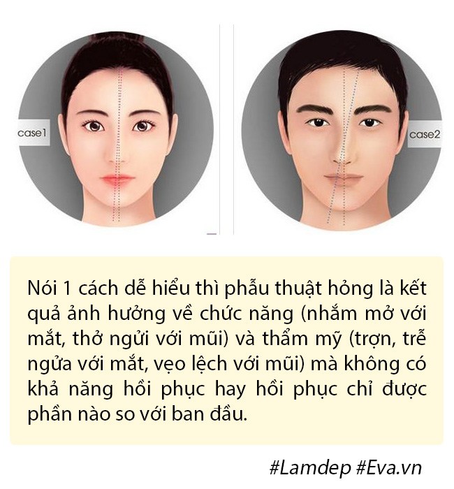 Dao k&eacute;o hỏng: Nỗi khổ của bệnh nh&acirc;n v&agrave; c&aacute;i kh&oacute; của b&aacute;c sĩ - Ảnh 7.