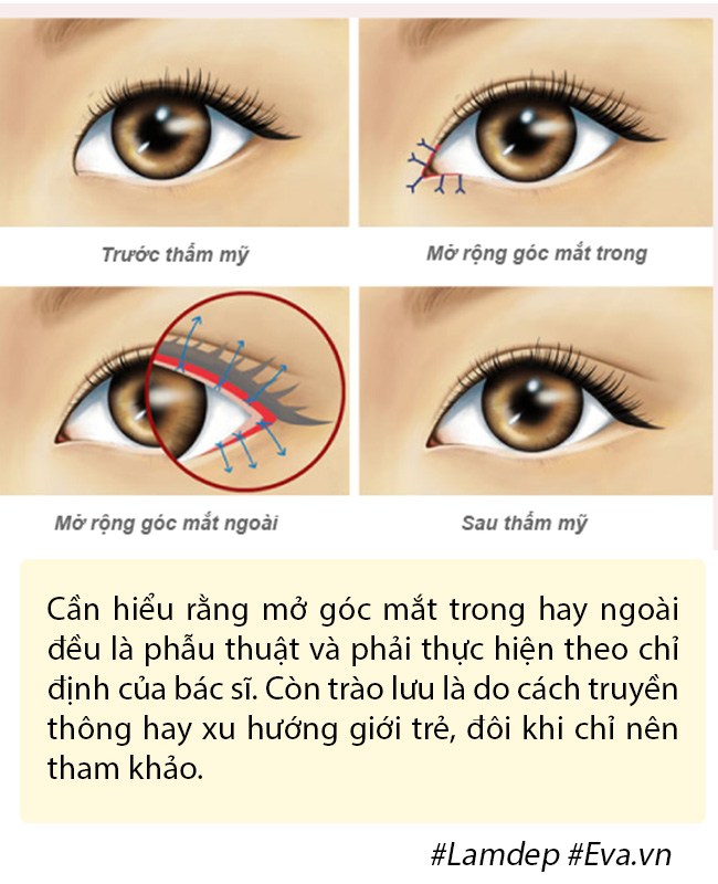 Dao k&eacute;o hỏng: Nỗi khổ của bệnh nh&acirc;n v&agrave; c&aacute;i kh&oacute; của b&aacute;c sĩ - Ảnh 10.