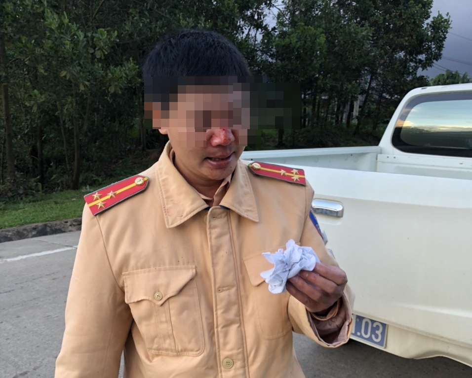 Bị y&ecirc;u cầu khai b&aacute;o y tế, thanh ni&ecirc;n đ&aacute;nh 2 CSGT bị thương - Ảnh 1.