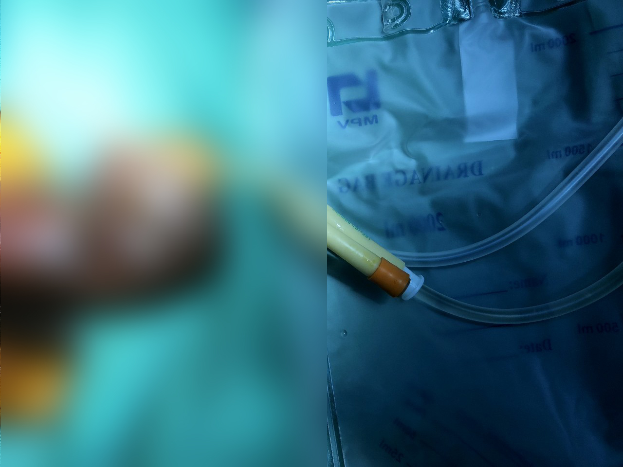 Trong lúc cho dê ăn cỏ, người đàn ông gãy dương vật vì bị ngã
