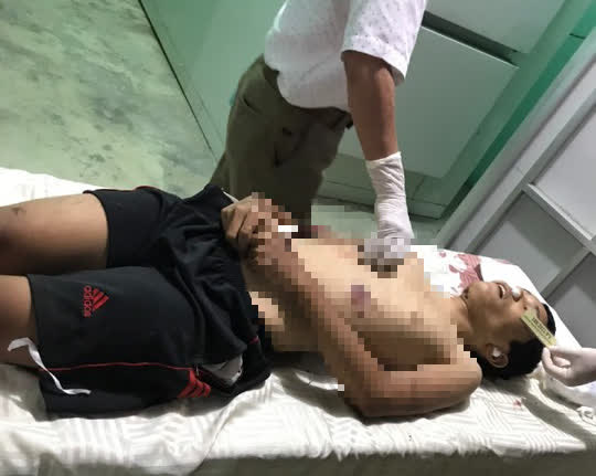 Đi qua đường sắt, một nam thanh niên bị tàu lửa cán chết