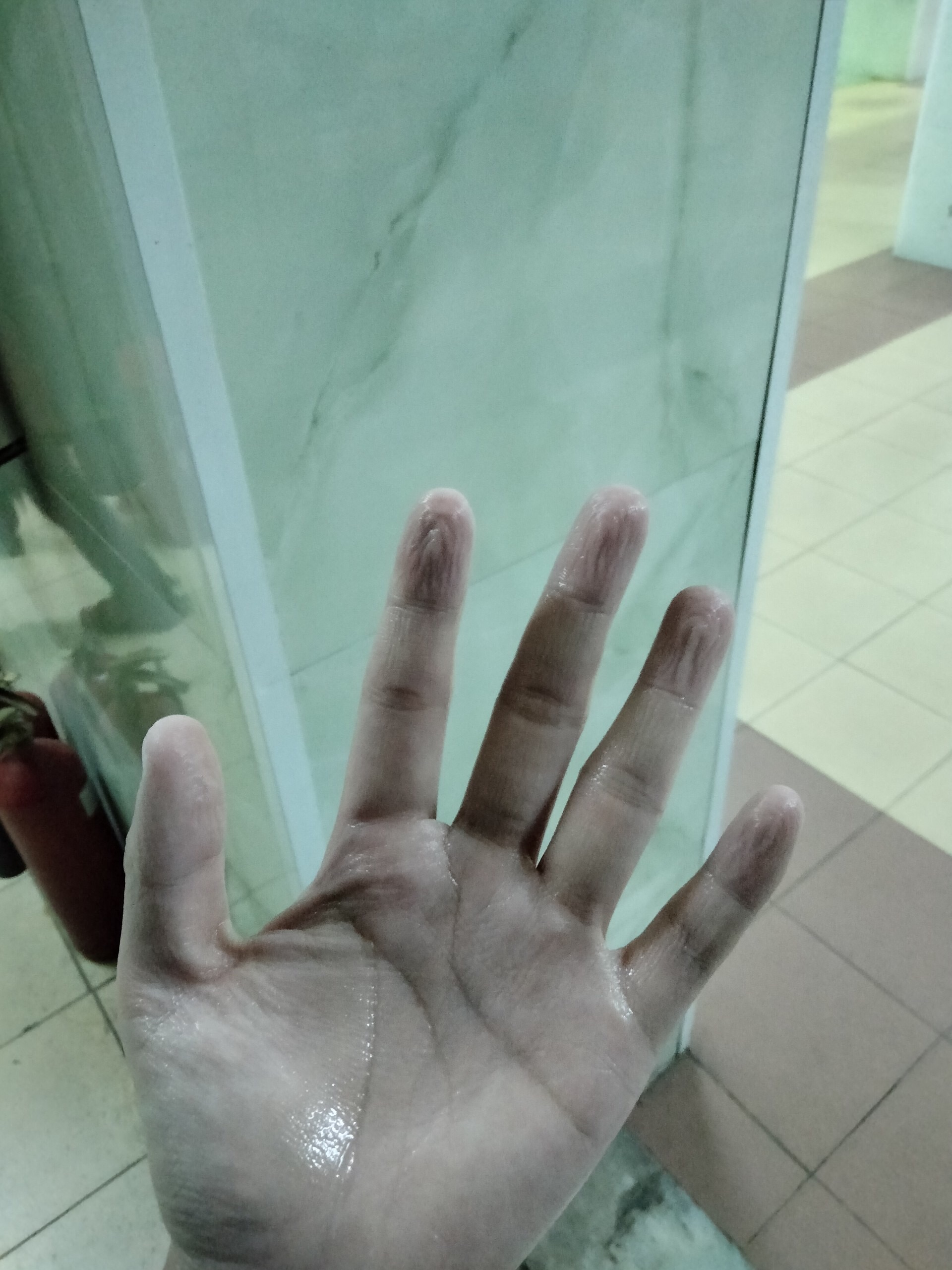 Nhật k&yacute; chống dịch: H&agrave;nh trang t&ocirc;i mang theo l&agrave; nhiệt huyết tuổi trẻ - Ảnh 5.