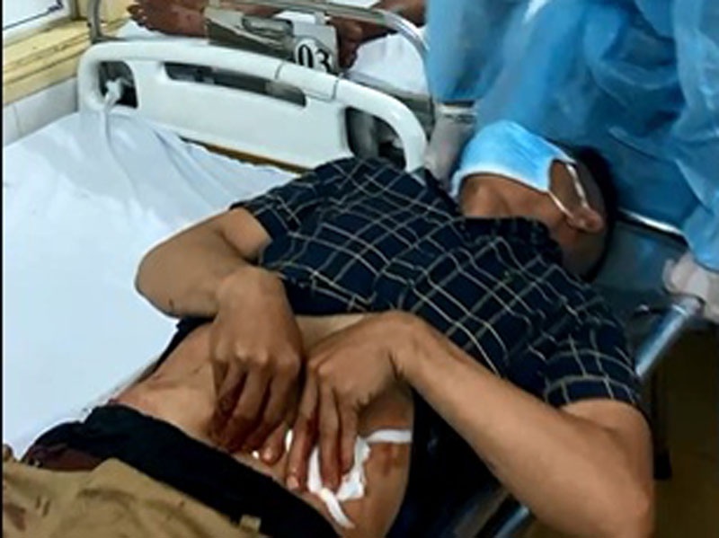 Hỗn chiến kinh hoàng ở cảng cá Quy Nhơn, 5 người bốc vác bị chém trọng thương