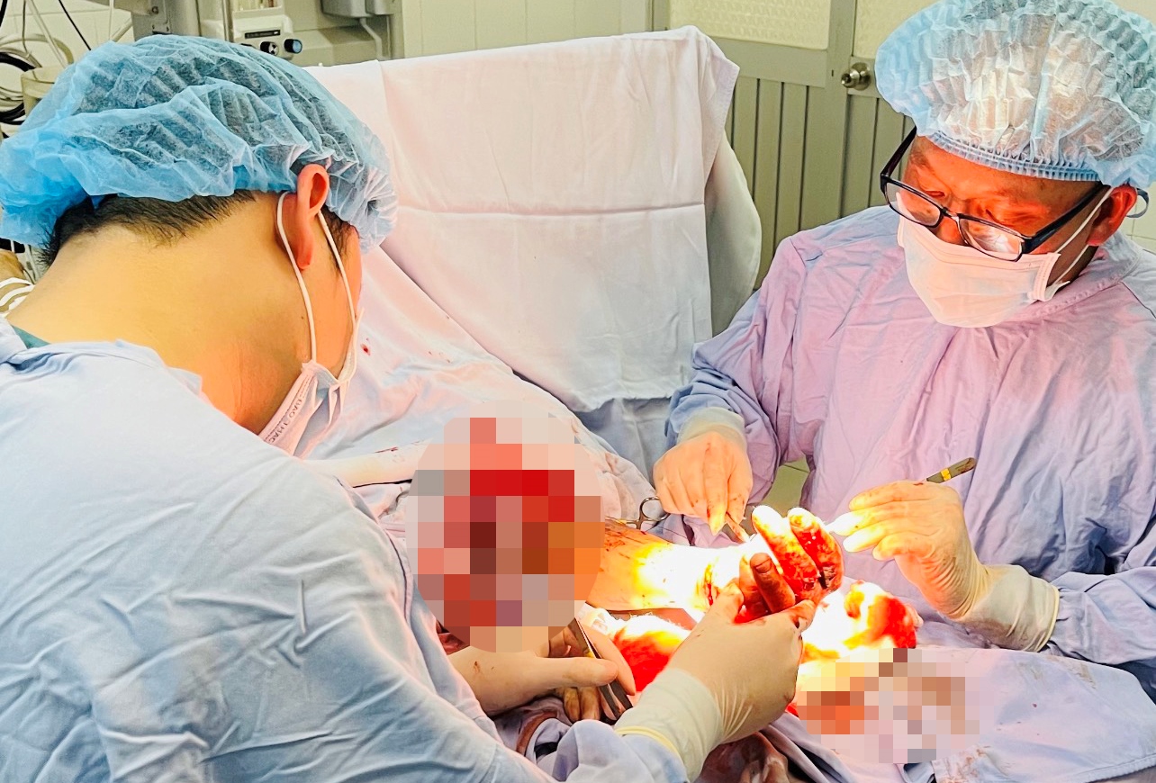Nối thành công bàn tay người đàn ông bị đứt lìa do tai nạn lao động