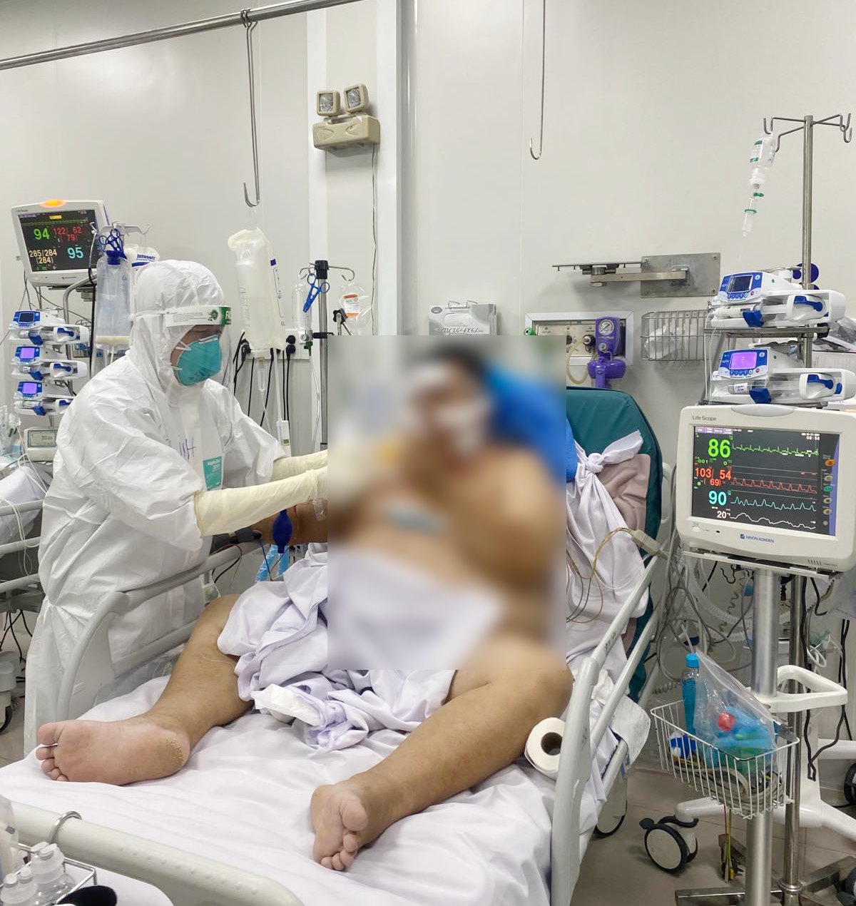 TP HCM: Cứu sống 2 bệnh nhân Covid-19 nguy kịch