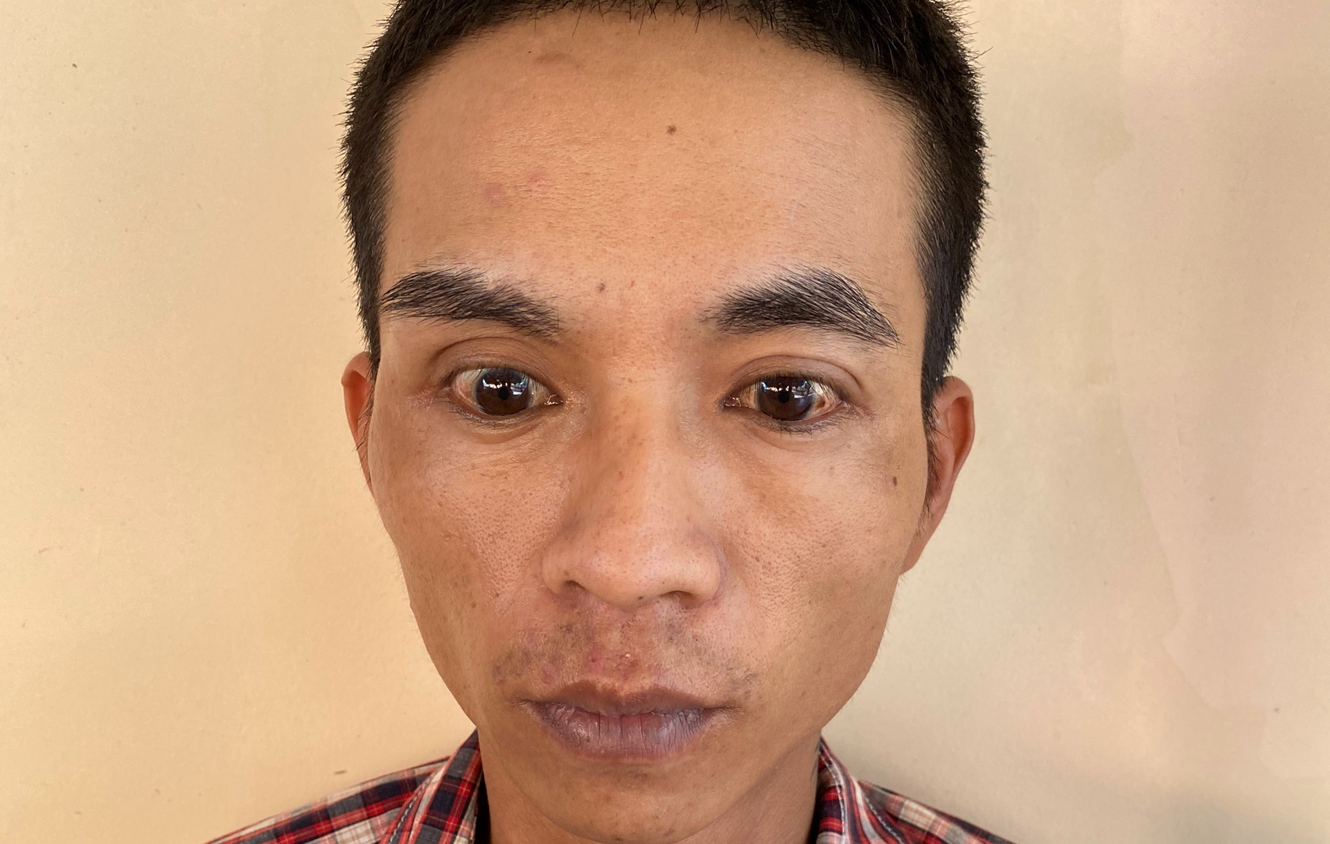 Vụ hỗn chiến náo loạn Bệnh viện Đa khoa Quảng Nam là do mâu thuẫn hàng xóm