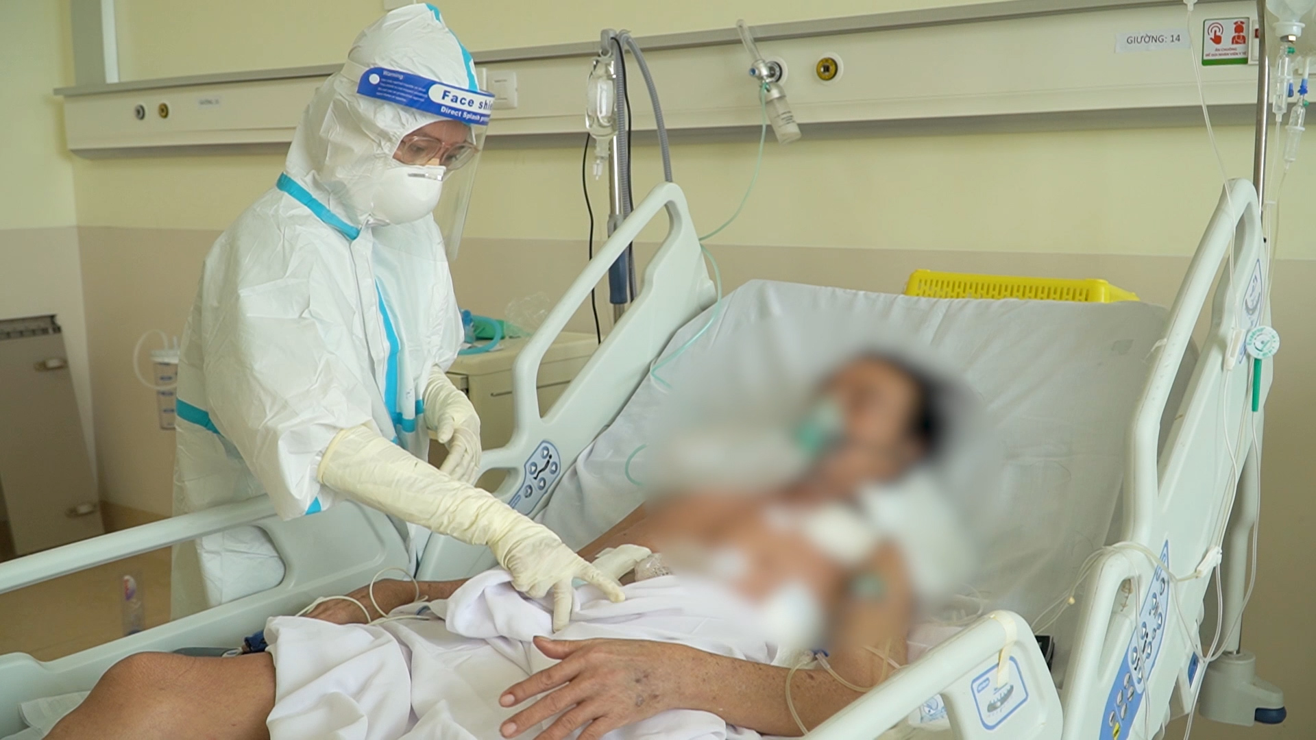 Lần đầu ti&ecirc;n Bệnh viện Hồi sức Covid-19 phẫu thuật u đại tr&agrave;ng cho bệnh nh&acirc;n mắc Covid-19 nặng - Ảnh 2.