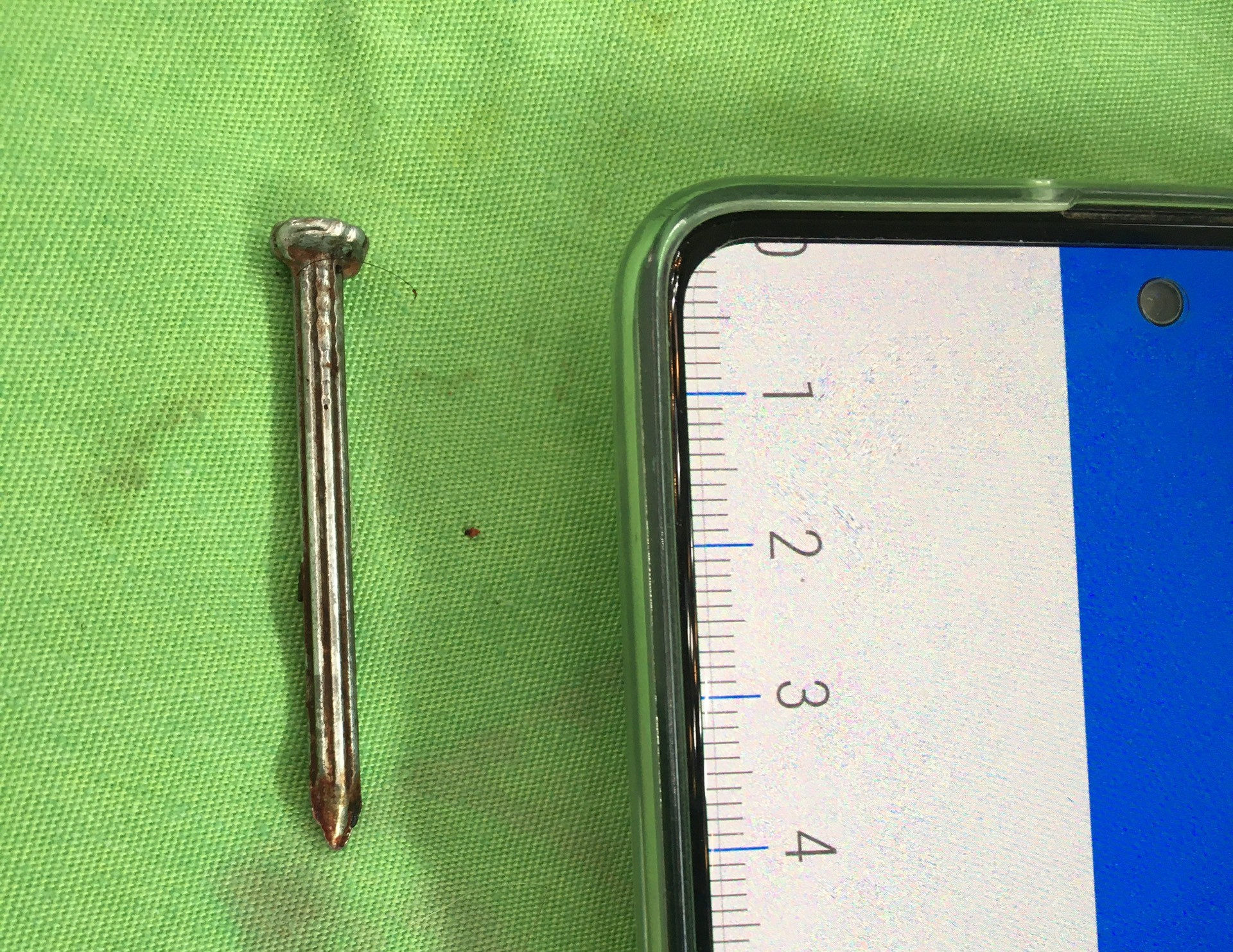 Bị trầm cảm 12 năm, cụ ông tự lấy đinh đóng vào đầu