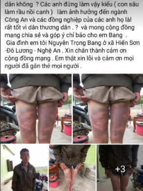 Xôn xao thông tin người đàn ông bị hành hung khi được đưa về trụ sở UBND xã