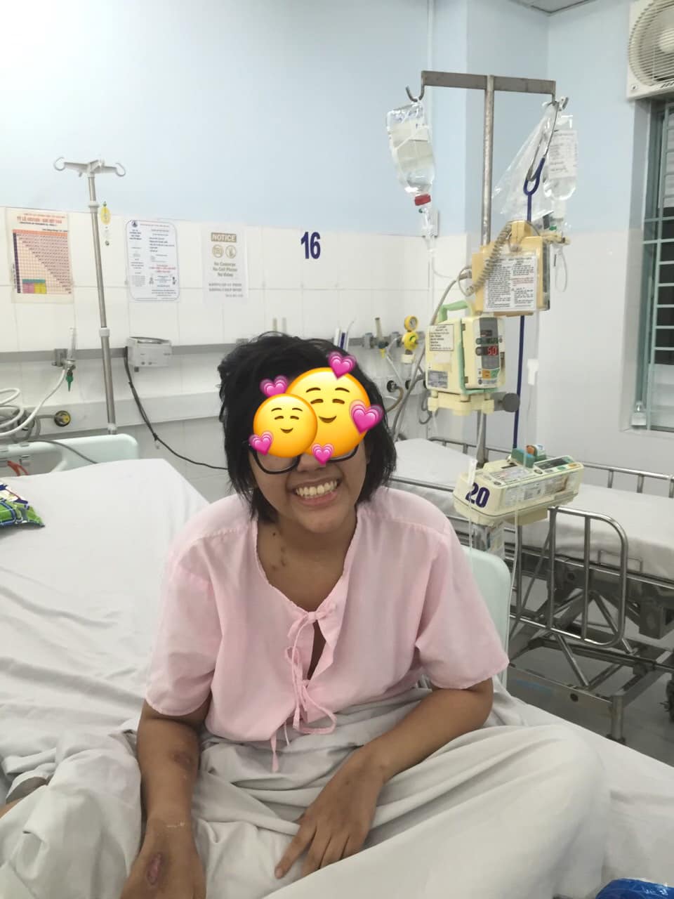 70 ng&agrave;y hồi sinh c&ocirc; b&eacute; vi&ecirc;m cơ tim nặng, hiếm gặp - Ảnh 2.