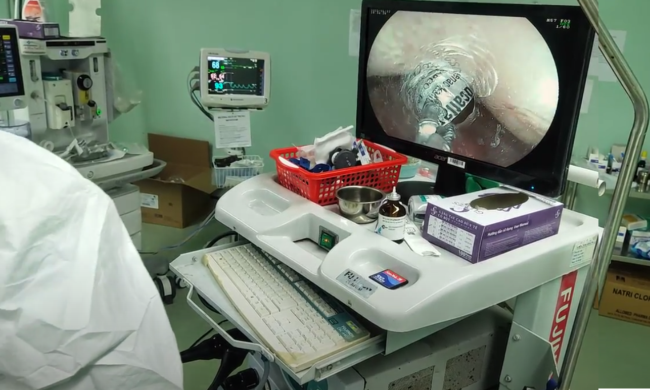 V&ocirc; &yacute; khi uống thuốc, 1 bệnh nh&acirc;n mắc Covid-19 su&yacute;t đứt d&acirc;y thanh - Ảnh 1.