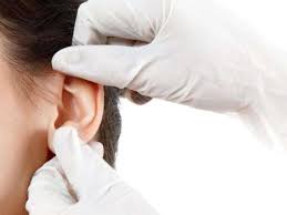 Bị áp xe rò luân nhĩ có chữa hết không?