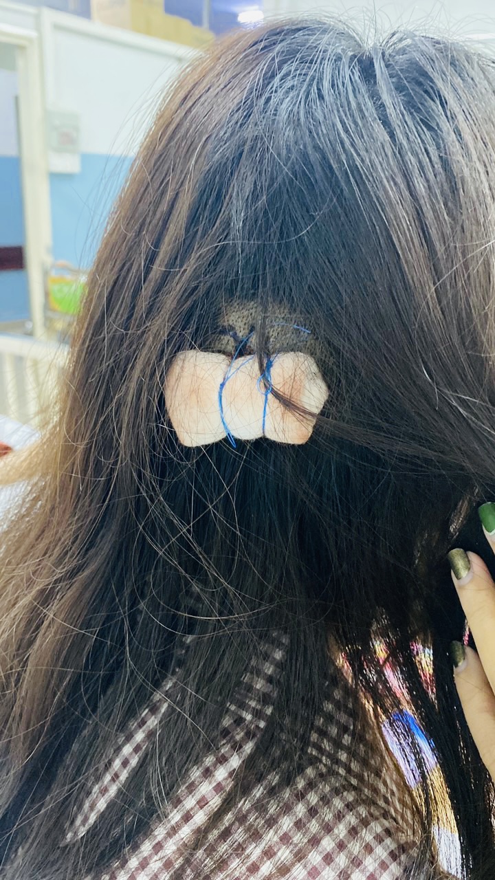 4 cô gái bị đánh đập ở Thủ Đức: Họ truy sát rất dã man! - Ảnh 1.