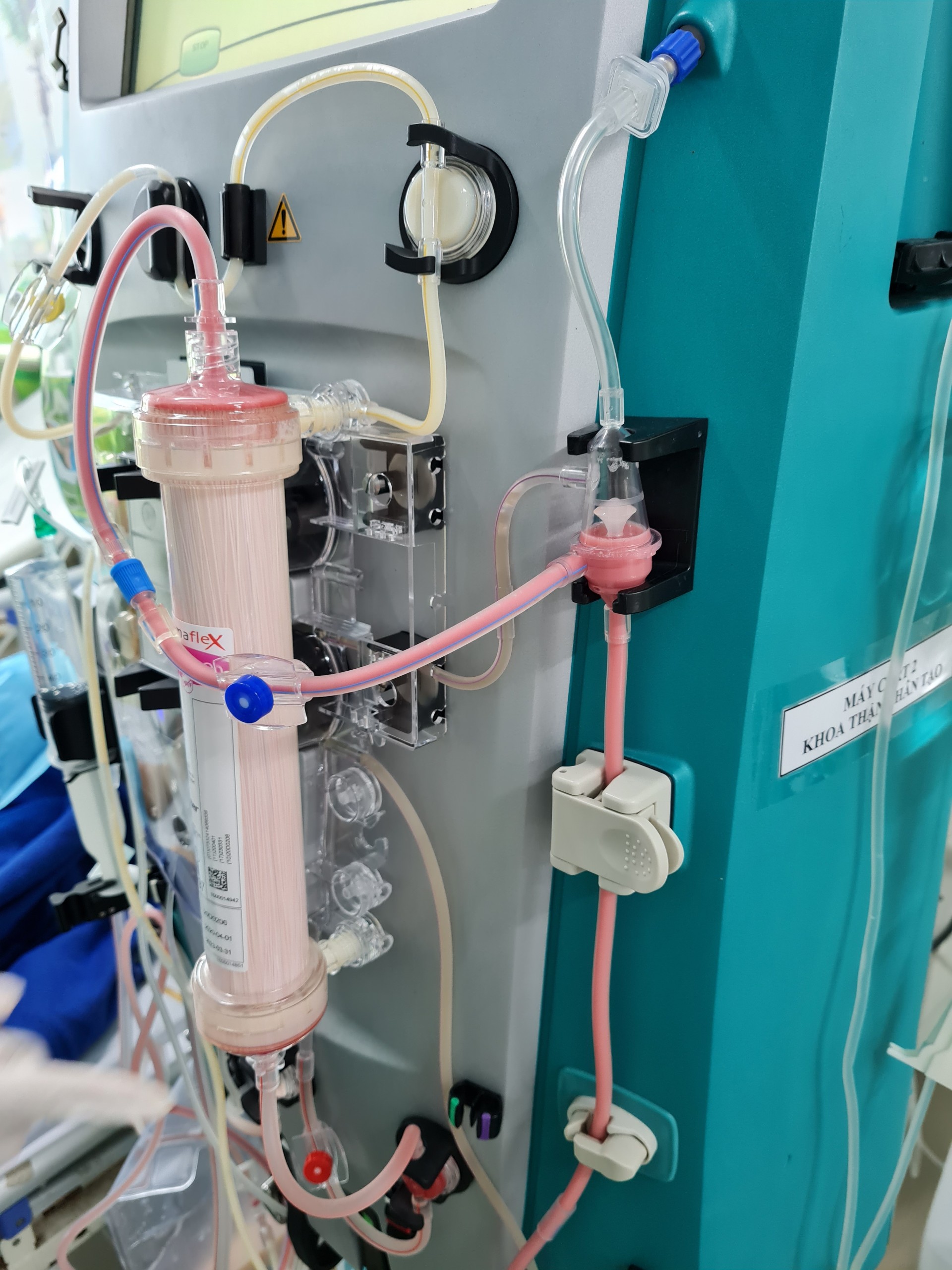 Căn bệnh khiến người phụ nữ có máu trắng đục như sữa